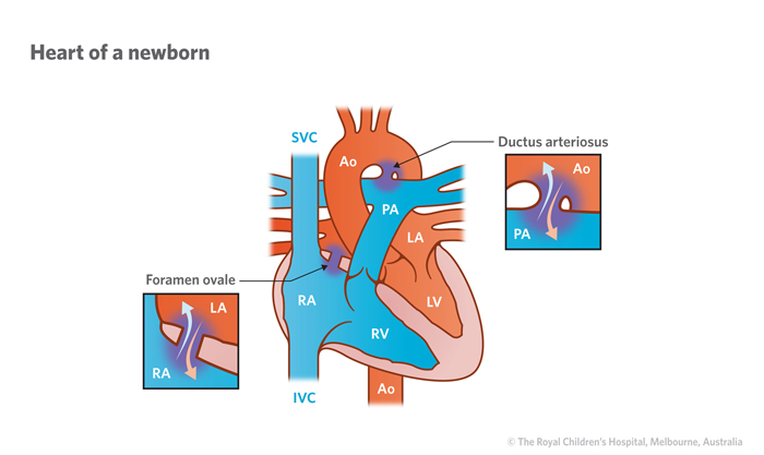 12c_Normal_heart