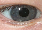 A close up of a person's eye  Description automatically generated