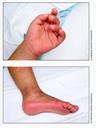 Extremities 1 Extremities 1