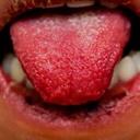 Lips and oral mucosa 1 Lips and oral mucosa 1