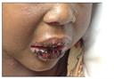 Lips and oral mucosa 2 Lips and oral mucosa 2