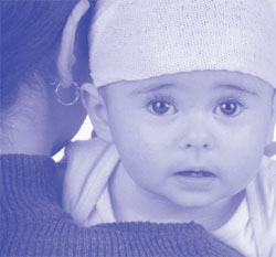 Eczma baby