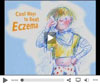 eczma