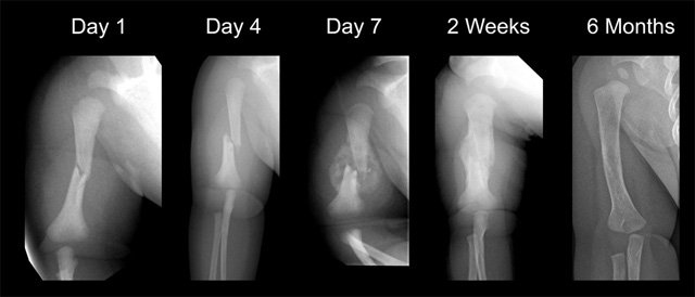 figure9_remodelling