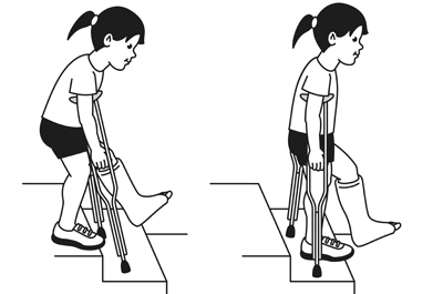 crutches stairs down going using weight step child leg sit slowly remember points key onto rch