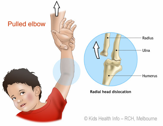 Radial Bone