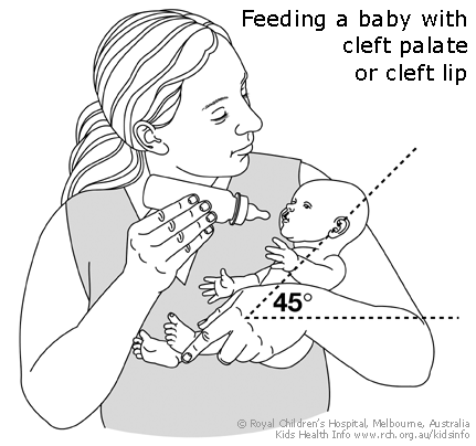 Cleft-feeding