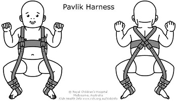 Pavlik harness for DDH
