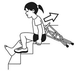 Crutches - unsafe using crutches on stairs