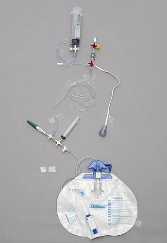 intra_abdominal_pressure_pic intra_abdominal_pressure_pic