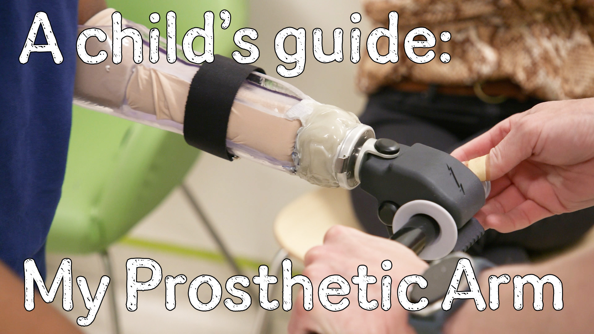 PRO My prosthetic arm