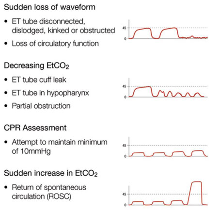 Clinical Practice Guidelines : Emergency airway management