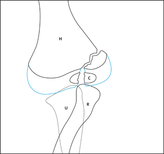 clinical practice guidelines lateral condyle fracture of the
