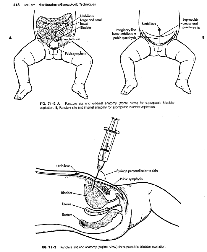 SPA - diagram