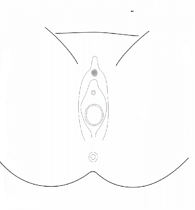 Clinical Practice Guidelines : Child Abuse Diagrams