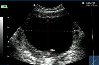 Longitudinal image