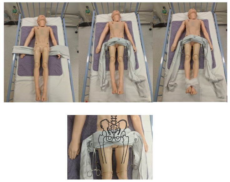 Circumferential-sheet-method