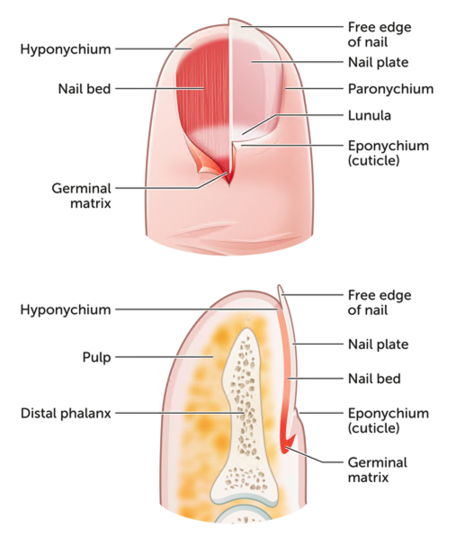 Subungual Hematoma - American Osteopathic College of Dermatology (AOCD)