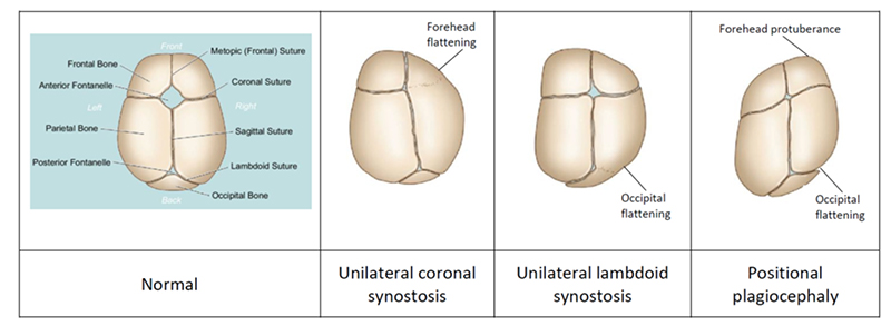 Differential diagnosis  image 1