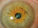 A close up of a person's eye  Description automatically generated with medium confidence