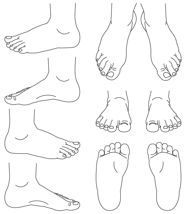 Injury Location Chart Body Map