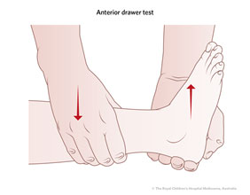 Anterior draw test