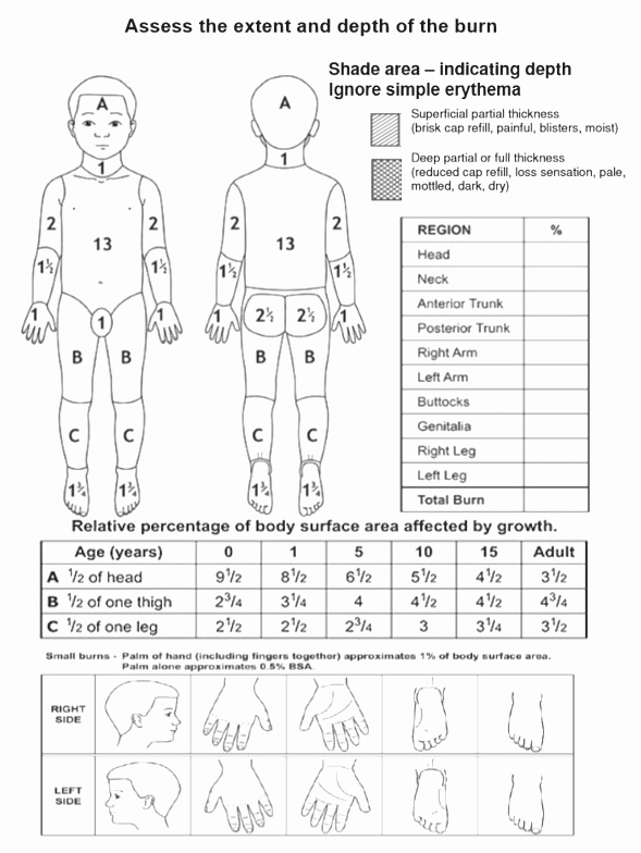 Nurse's Study Guide To Burns, PDF, Burn