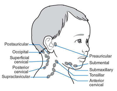 Cervical Lymphadenopathy 1