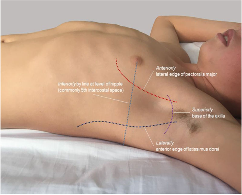 Thoracocentesis & Chest Drain