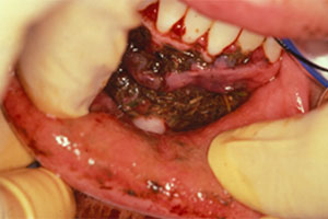 dental_trauma10