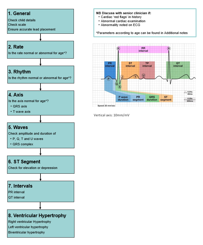 ECG diagram