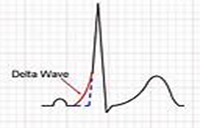 ECG image 10 ECG image 10