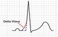 ECG image 10