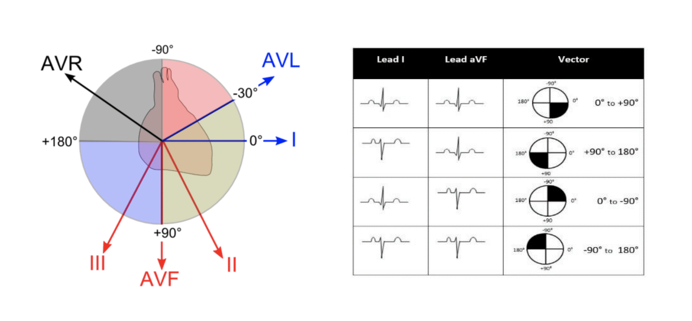 ECG image 2