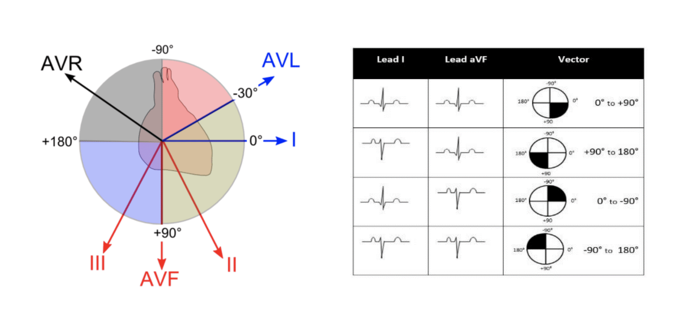 Normal Ecg Paediatric
