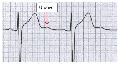 ECG image 8 ECG image 8