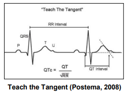 ECG image 9