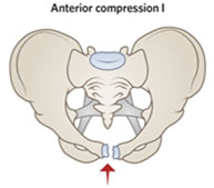 Some pubic symphysis widening