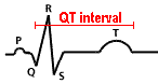 QT interval