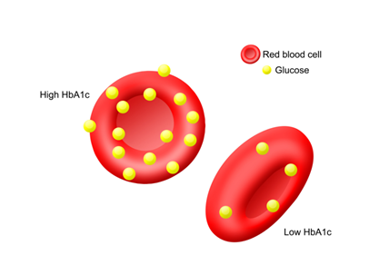 Diabetes at the RCH : HbA1c - what does this mean