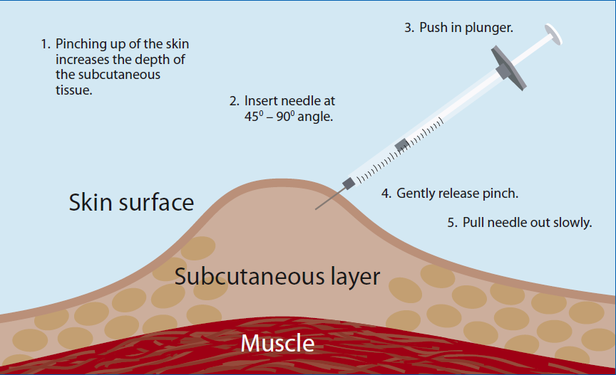 How to give an insulin injection image