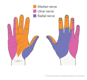 Fracture Education : Evaluation