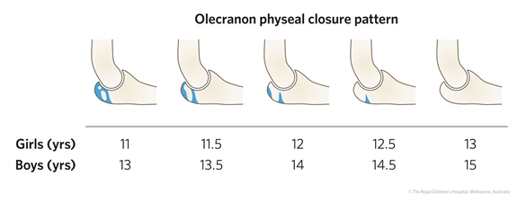 Growth Plate Closure Chart