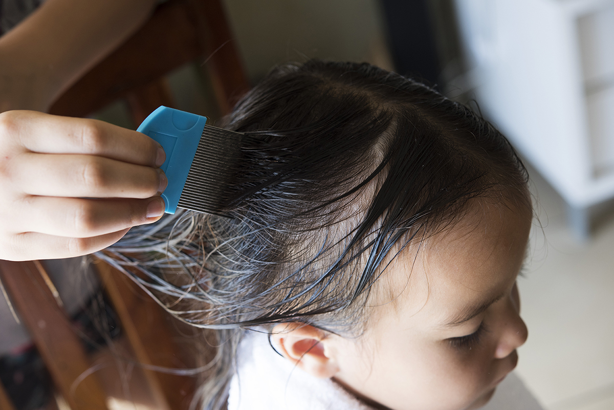 20251006_KHI_HeadLiceandNits_StockPhoto_shutterstock_390106093 blue-head-lice-comb-brushing-through-dark-hair-of-young-girl