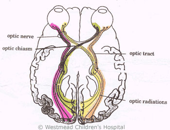 ABI Visual Pathways