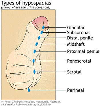 Israel woman erotica