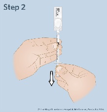 Midazolam_intranasal_2