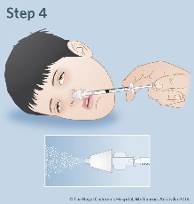 Midazolam_intranasal_4