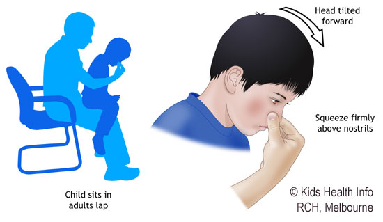 7 Tips To Prevent Nose Bleeds In Summer