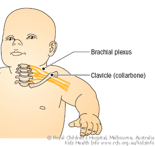 brachial-plexus